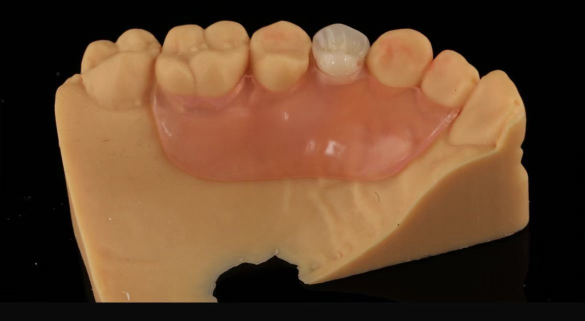 Flexible Aesthetic Flipper