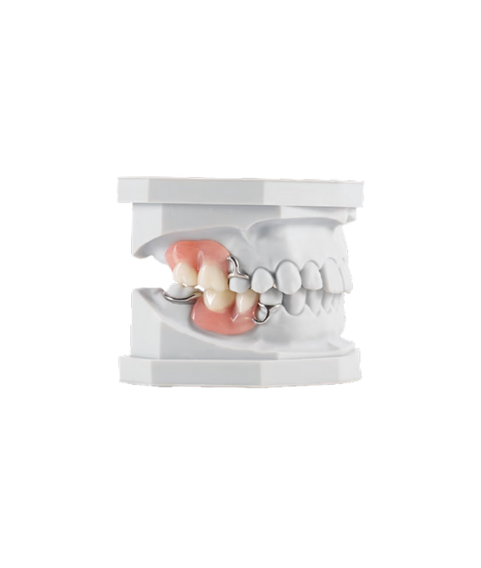 Acrylic Partial Denture
