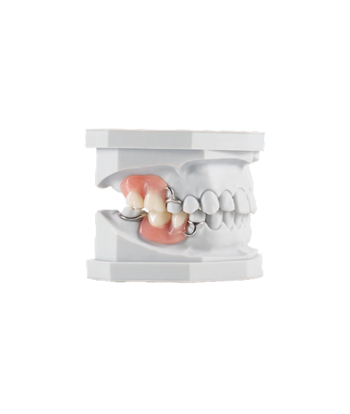 Acrylic Partial Denture