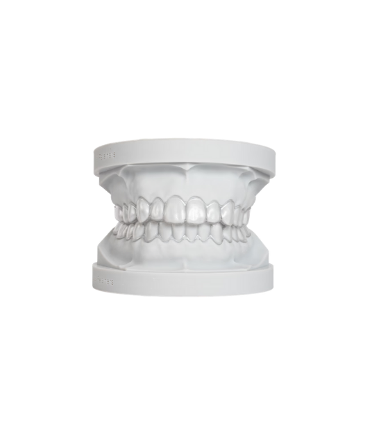 Aligners Treatment