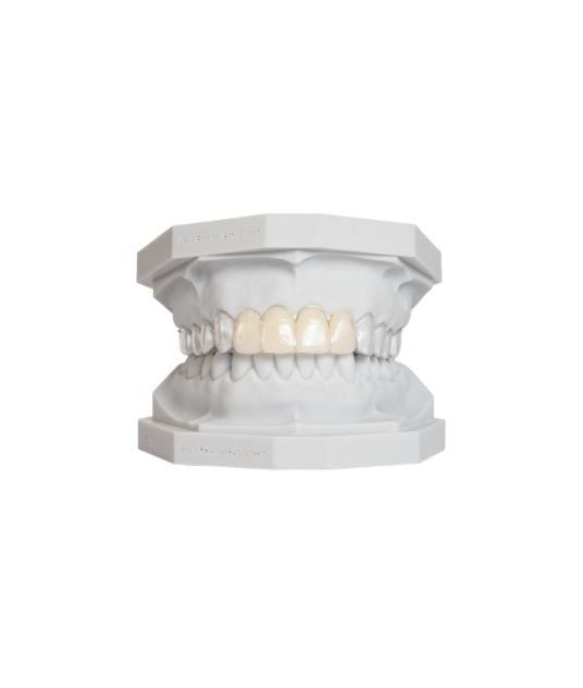 Clear Retainers with teeth