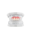 Prótesis dental flexible irrompible