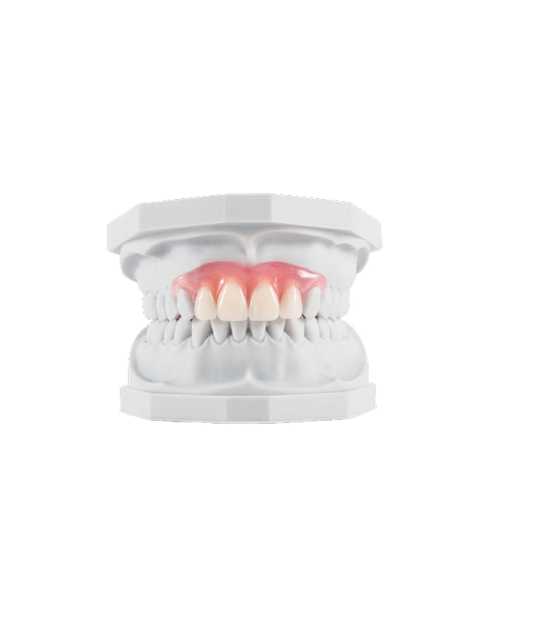 Unbreakable Flexible Denture