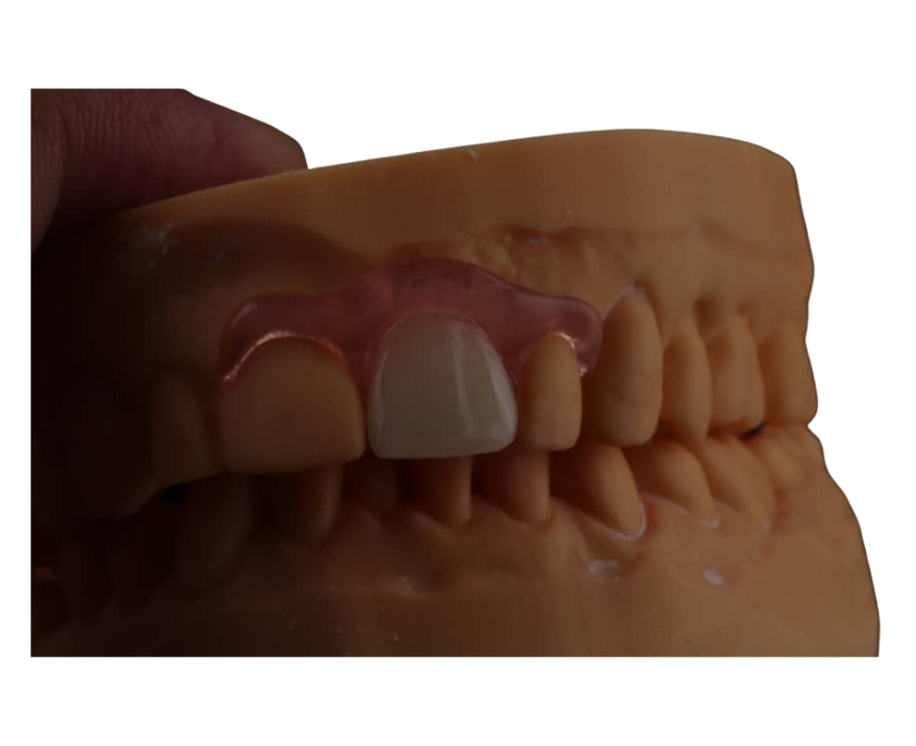 Flexible Aesthetic Flipper