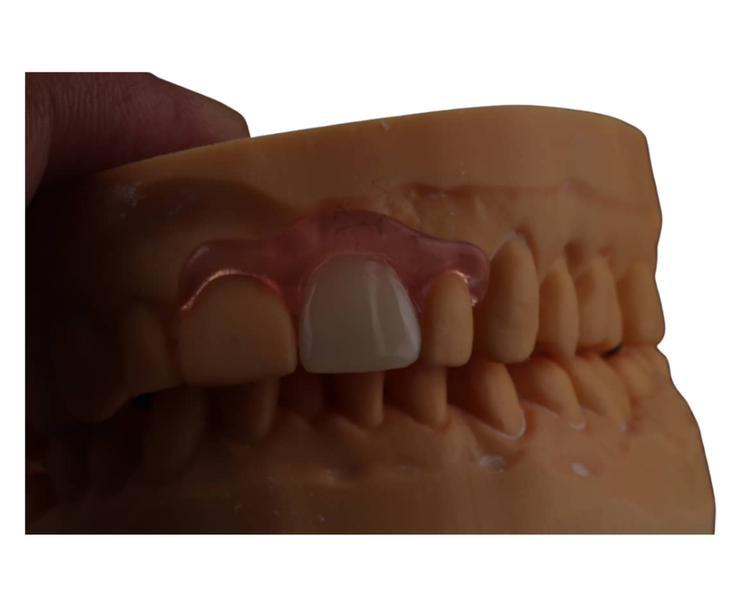 Flexible Aesthetic Flipper