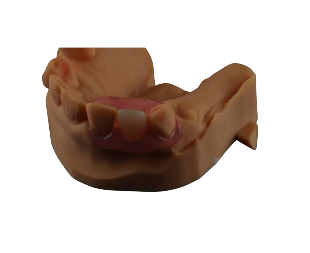 Flexible Aesthetic Flipper