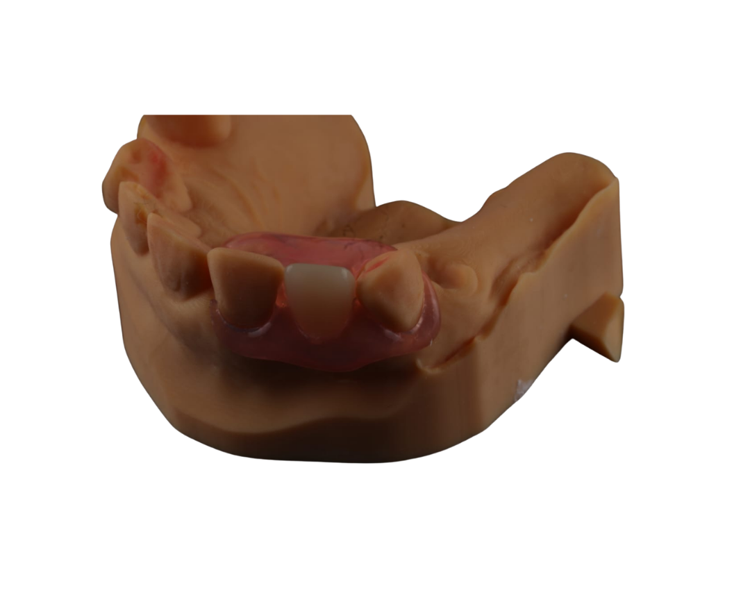 Flexible Aesthetic Flipper