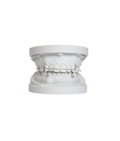 Hawley Orthodontic Retainer