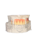 Acrylic Partial Denture
